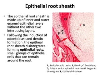 Epithelial root sheath
• The epithelial root sheath is
  made up of inner and outer
  enamel epithelial layers
  without the other two
  interposing layers.
• Following the induction of
  odontoblast and dentin
  formation, the epitheal
  root sheath disintegrates
  forming epithelial rests,
  small groups of epithelial
  cells that can remain
  around the root.
                             A, Radicular pulp cavity; B, Dentin; C, Dental sac;
                             D, Point at which epithelial root sheath begins to
                             disintegrate; E, Epithelial diaphram
 