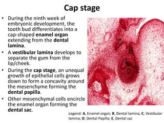 Cap stage
• During the ninth week of
  embryonic development, the
  tooth bud differentiates into a
  cap-shaped enamel organ
  extending from the dental
  lamina.
• A vestibular lamina develops to
  separate the gum from the
  lip/cheek.
• During the cap stage, an unequal
  growth of epithelial cells grows
  down to form a concavity around
  the mesenchyme forming the
  dental papilla.
• Other mesenchymal cells encircle
  the enamel organ forming the
  dental sac.
                           Legend: A, Enamel organ; B, Dental lamina; C, Vestibular
                           lamina; D, Dental Papilla; E, Dental sac
 