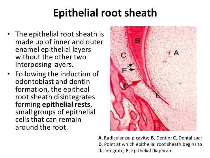 HERTWIGS EPITHELIAL ROOT SHEATH PDF HERTWIGS EPITHELIAL ROOT SHEATH PDF