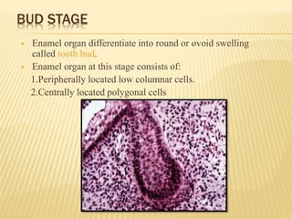 BUD STAGE
 Enamel organ differentiate into round or ovoid swelling
called tooth bud.
 Enamel organ at this stage consists of:
1.Peripherally located low columnar cells.
2.Centrally located polygonal cells
 