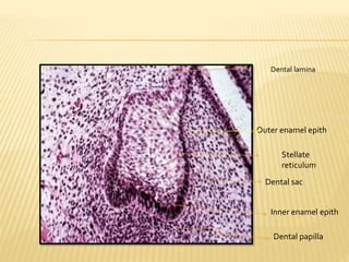 Outer enamel epith
Stellate
reticulum
Dental sac
Dental papilla
Inner enamel epith
Dental lamina
 