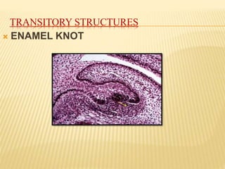 TRANSITORY STRUCTURES
 ENAMEL KNOT
 