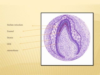Stellate reticulum
Enamel
Dentin
OEE
odontoblasts
 