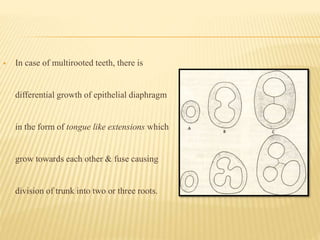  In case of multirooted teeth, there is
differential growth of epithelial diaphragm
in the form of tongue like extensions which
grow towards each other & fuse causing
division of trunk into two or three roots.
 