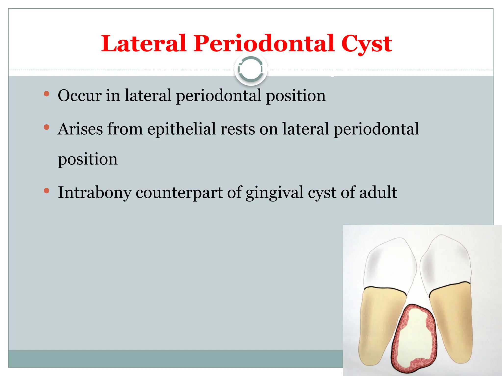 Seminar on dental Odontogenic-cysts-IV.pptx