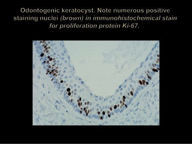 Odontogenic cyst dina patho