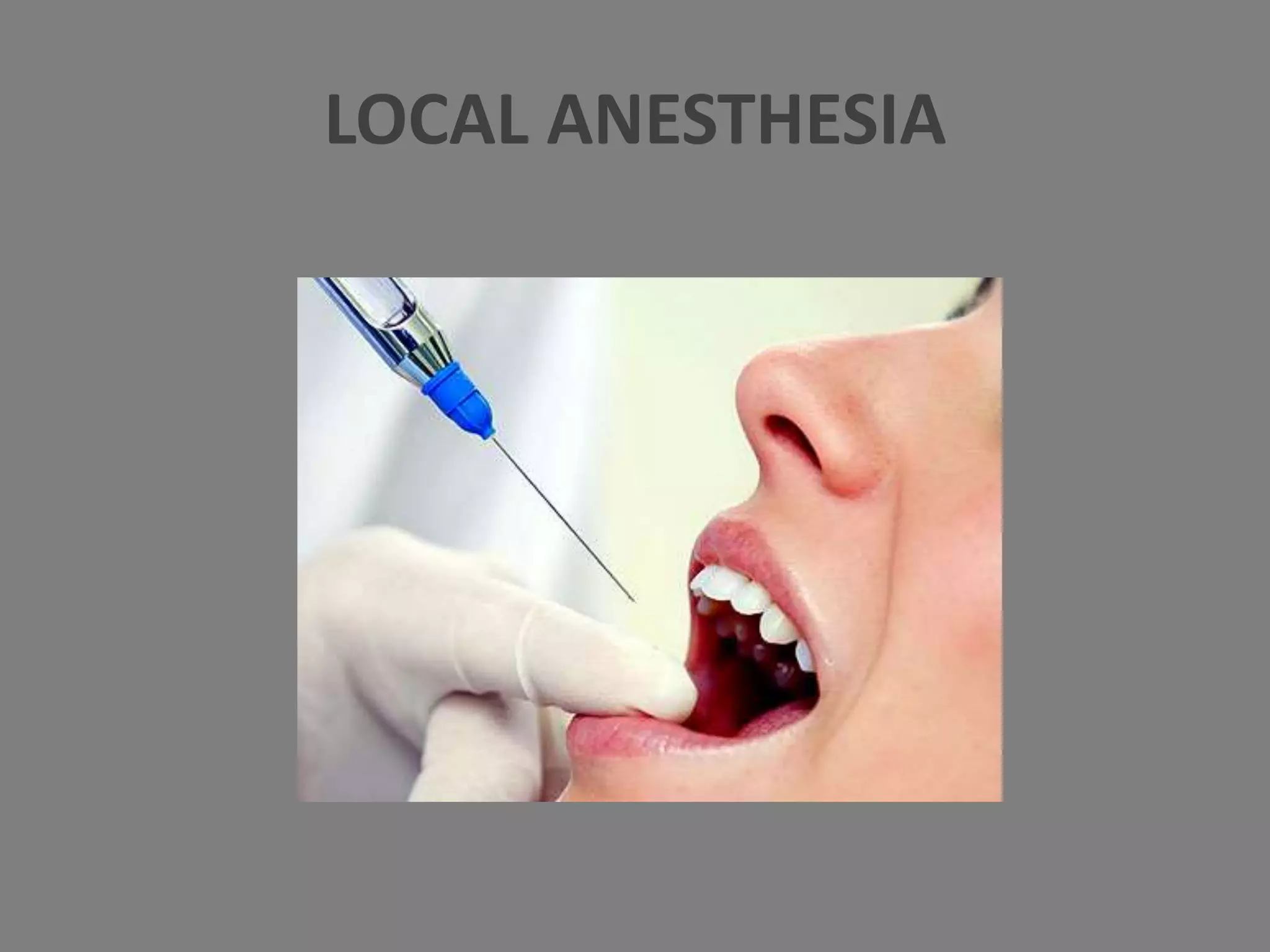 LOCAL ANESTHESIA
 