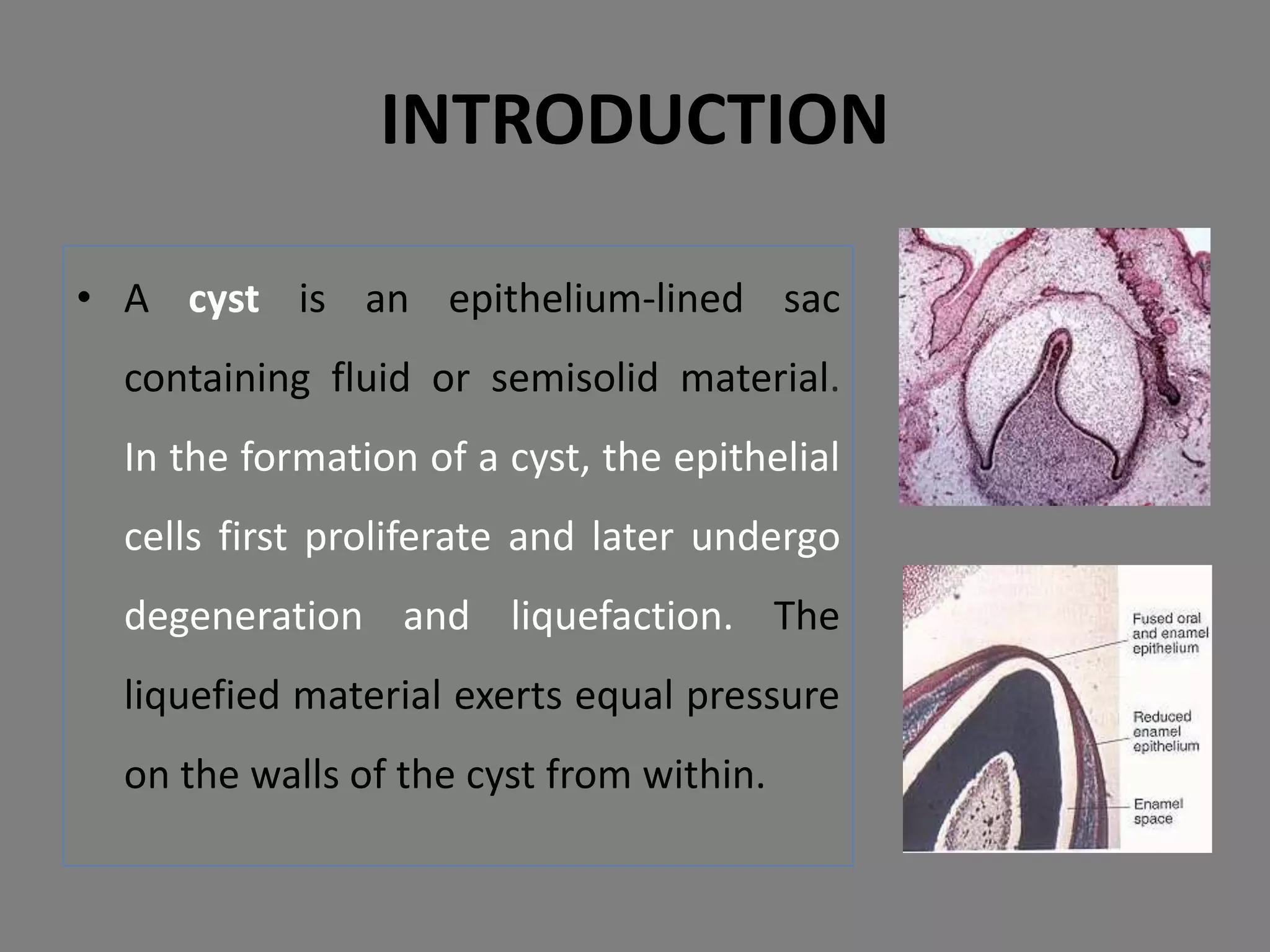 • A cyst is an epithelium-lined sac
containing fluid or semisolid material.
In the formation of a cyst, the epithelial
cells first proliferate and later undergo
degeneration and liquefaction. The
liquefied material exerts equal pressure
on the walls of the cyst from within.
INTRODUCTION
 