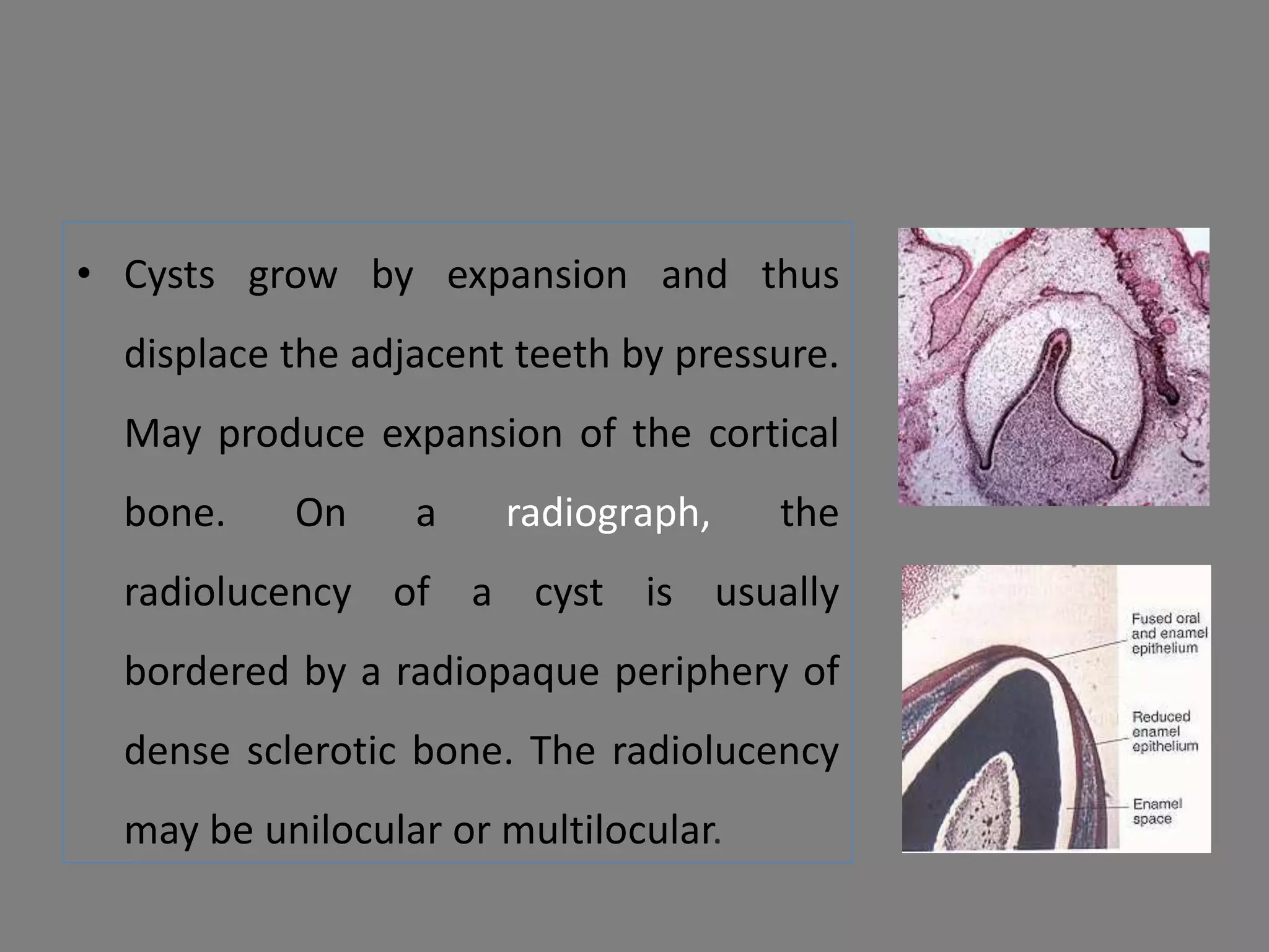 • Cysts grow by expansion and thus
displace the adjacent teeth by pressure.
May produce expansion of the cortical
bone. On a radiograph, the
radiolucency of a cyst is usually
bordered by a radiopaque periphery of
dense sclerotic bone. The radiolucency
may be unilocular or multilocular.
 