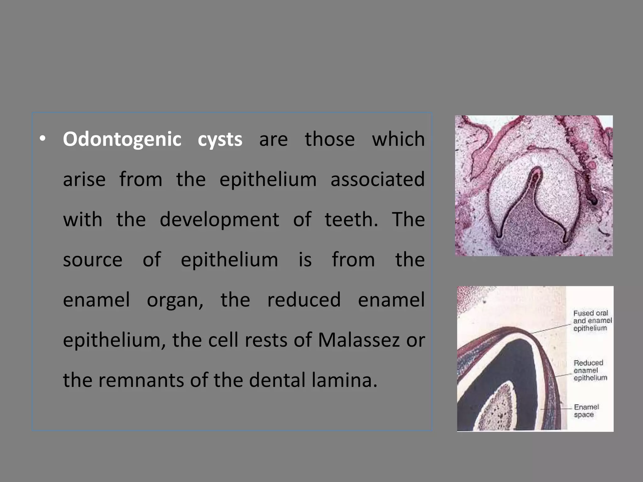 • Odontogenic cysts are those which
arise from the epithelium associated
with the development of teeth. The
source of epithelium is from the
enamel organ, the reduced enamel
epithelium, the cell rests of Malassez or
the remnants of the dental lamina.
 