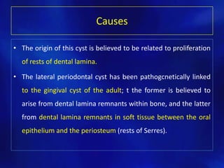 Causes
• The origin of this cyst is believed to be related to proliferation
of rests of dental lamina.
• The lateral periodontal cyst has been pathogcnetically linked
to the gingival cyst of the adult; t the former is believed to
arise from dental lamina remnants within bone, and the latter
from dental lamina remnants in soft tissue between the oral
epithelium and the periosteum (rests of Serres).
 