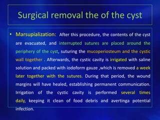 Surgical removal the of the cyst
• Marsupialization: After this procedure, the contents of the cyst
are evacuated, and interrupted sutures are placed around the
periphery of the cyst, suturing the mucoperiosteum and the cystic
wall together . Afterwards, the cystic cavity is irrigated with saline
solution and packed with iodoform gauze ,which is removed a week
later together with the sutures. During that period, the wound
margins will have healed, establishing permanent communication.
Irrigation of the cystic cavity is performed several times
daily, keeping it clean of food debris and avertinga potential
infection.
 