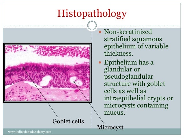 Odontogenic cysts v /orthodontic courses by Indian dental 