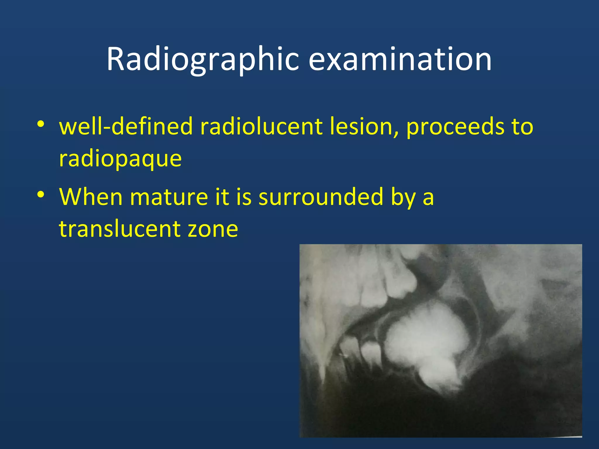 Radiographic examination
• well-defined radiolucent lesion, proceeds to
radiopaque
• When mature it is surrounded by a
translucent zone
 