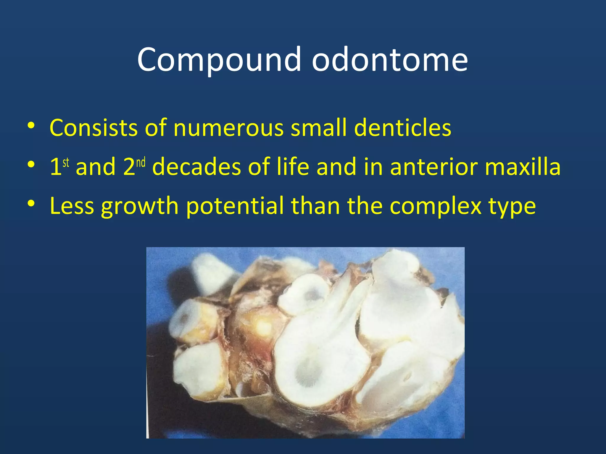 Compound odontome
• Consists of numerous small denticles
• 1st
and 2nd
decades of life and in anterior maxilla
• Less growth potential than the complex type
 