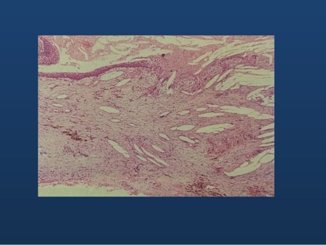 Odontogenic cysts and tumors (ppt)