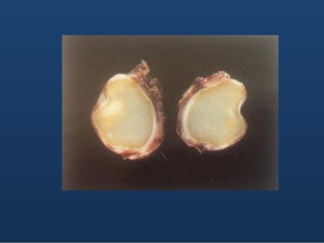 Odontogenic cysts and tumors (ppt)