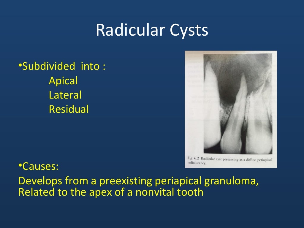Odontogenic cysts and tumors (ppt)