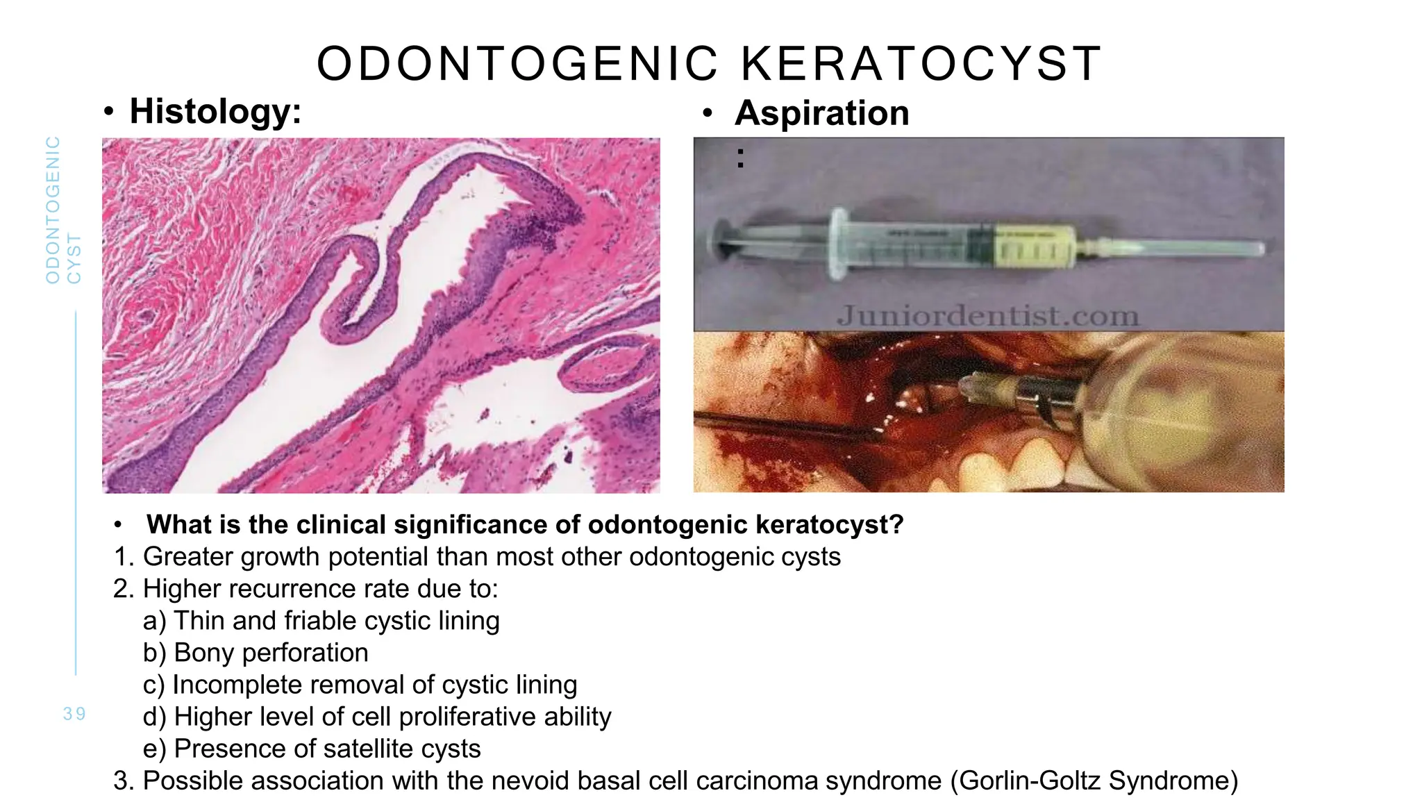 ODONTOGENIC CYSTS OF THE JAWS AND THE MANAGEMENT | PPTX