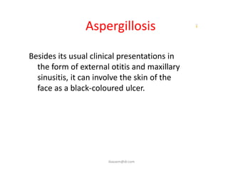 Aspergillosis

Besides its usual clinical presentations in
  the form of external otitis and maxillary
  sinusitis, it can involve the skin of the
  face as a black-coloured ulcer.




                      ikassem@dr.com
 