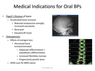 Medical Indications for Oral BPs
• Paget’s Disease of bone
    – Accelerated bone turnover
       • Reduced compressive strength,
          increased vascularity
       • Bone pain
       • Elevated AP levels
• Osteoporosis
    – Effects of estrogen loss:
        • Decreased bone
           turnover/renewal
             – Adipocyte differentiation >
                osteoblastic differentiation
             – increased fibrofatty marrow
             – Progressively porotic bone
    – DEXA scan for BMD values
                                       ikassem@dr.com
 