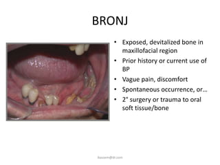 BRONJ
         • Exposed, devitalized bone in
           maxillofacial region
         • Prior history or current use of
           BP
         • Vague pain, discomfort
         • Spontaneous occurrence, or…
         • 2° surgery or trauma to oral
           soft tissue/bone




ikassem@dr.com
 