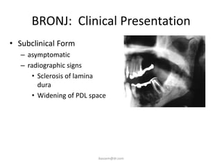 BRONJ: Clinical Presentation
• Subclinical Form
   – asymptomatic
   – radiographic signs
      • Sclerosis of lamina
        dura
      • Widening of PDL space




                          ikassem@dr.com
 