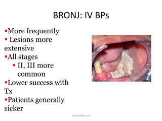 BRONJ: IV BPs
More frequently
 Lesions more
extensive
All stages
    II, III more
     common
Lower success with
Tx
Patients generally
sicker
                      ikassem@dr.com
 