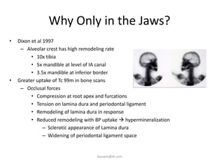 Why Only in the Jaws?
•   Dixon et al 1997
     – Alveolar crest has high remodeling rate
          • 10x tibia
          • 5x mandible at level of IA canal
          • 3.5x mandible at inferior border
•   Greater uptake of Tc 99m in bone scans
     – Occlusal forces
          • Compression at root apex and furcations
          • Tension on lamina dura and periodontal ligament
          • Remodeling of lamina dura in response
          • Reduced remodeling with BP uptake  hypermineralization
                – Sclerotic appearance of Lamina dura
                – Widening of periodontal ligament space


                                    ikassem@dr.com
 