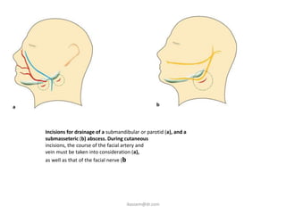 Incisions for drainage of a submandibular or parotid (a), and a
submasseteric (b) abscess. During cutaneous
incisions, the course of the facial artery and
vein must be taken into consideration (a),
as well as that of the facial nerve (b




                                    ikassem@dr.com
 