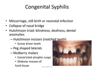 Congenital Syphilis

• Miscarriage, still birth or neonatal infection
• Collapse of nasal bridge
• Hutchinson triad: blindness, deafness, dental
  anomalies
   – Hutchinson incisors (notched teeth)
      • Screw driver teeth
   – Peg shaped laterals
   – Mulberry molars
      • Constricted atrophic cusps
      • Globular masses of
      hard tissue          ikassem@dr.com
 