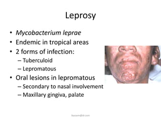 Leprosy
• Mycobacterium leprae
• Endemic in tropical areas
• 2 forms of infection:
  – Tuberculoid
  – Lepromatous
• Oral lesions in lepromatous
  – Secondary to nasal involvement
  – Maxillary gingiva, palate


                      ikassem@dr.com
 