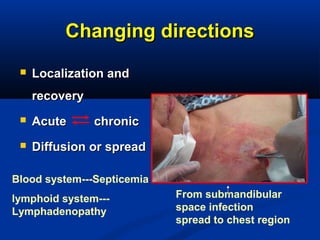 Changing directionsChanging directions
 Localization andLocalization and
recoveryrecovery
 Acute chronicAcute chronic
 Diffusion or spreadDiffusion or spread
Blood system---Septicemia
lymphoid system---
Lymphadenopathy
From submandibular
space infection
spread to chest region
 