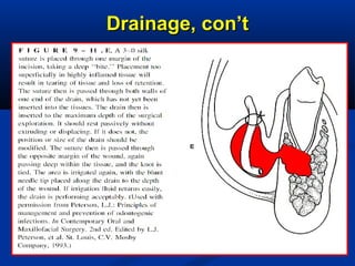 Drainage, con’tDrainage, con’t
 