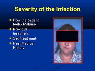  How the patientHow the patient
feels- Malaisefeels- Malaise
 PreviousPrevious
treatmenttreatment
 Self treatmentSelf treatment
 Past MedicalPast Medical
HistoryHistory
Severity of the InfectionSeverity of the Infection
 