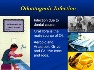 Odontogenic InfectionOdontogenic Infection
Infection due to
dental cause.
Oral flora is the
main source of OI:
Aerobic and
Anaerobic Gr-ve
and Gr. +ve cocci
and rods.
 