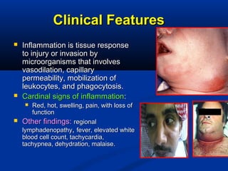 Clinical FeaturesClinical Features
 Inflammation is tissue responseInflammation is tissue response
to injury or invasion byto injury or invasion by
microorganisms that involvesmicroorganisms that involves
vasodilation, capillaryvasodilation, capillary
permeability, mobilization ofpermeability, mobilization of
leukocytes, and phagocytosis.leukocytes, and phagocytosis.
 Cardinal signs of inflammationCardinal signs of inflammation::
 Red, hot, swelling, pain, with loss ofRed, hot, swelling, pain, with loss of
functionfunction
 Other findings:Other findings: regionalregional
lymphadenopathylymphadenopathy,, fever, elevated whitefever, elevated white
blood cell count, tachycardia,blood cell count, tachycardia,
tachypnea, dehydration, malaise.tachypnea, dehydration, malaise.

 