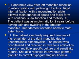  F, Panoramic view after left mandible resectionF, Panoramic view after left mandible resection
of osteomyelitis with pathologic fracture. Rigidof osteomyelitis with pathologic fracture. Rigid
internal fixation with a reconstruction plateinternal fixation with a reconstruction plate
allowed maintenance of space and facial formallowed maintenance of space and facial form
with continuous jaw function and mobility. G,with continuous jaw function and mobility. G,
The patient was asymptomatic for 2 years beforeThe patient was asymptomatic for 2 years before
having pain and swelling in the anteriorhaving pain and swelling in the anterior
mandible. Débridement revealed necrotic moth-mandible. Débridement revealed necrotic moth-
eaten bone.eaten bone.
 H, The patient eventually required removal ofH, The patient eventually required removal of
the remainder of the right mandible due tothe remainder of the right mandible due to
uncontrollable osteomyelitis. The patient wasuncontrollable osteomyelitis. The patient was
hospitalized and received intravenous antibioticshospitalized and received intravenous antibiotics
based on multiple specific culture and sensitivitybased on multiple specific culture and sensitivity
reports. She also received intravenous gammareports. She also received intravenous gamma
globulin to correct hypogammaglobulinemia.globulin to correct hypogammaglobulinemia.
 