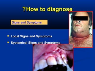 How to diagnoseHow to diagnose??
 Local Signs and SymptomsLocal Signs and Symptoms
 Systemical Signs and SymptomsSystemical Signs and Symptoms
Signs and Symptoms
 
