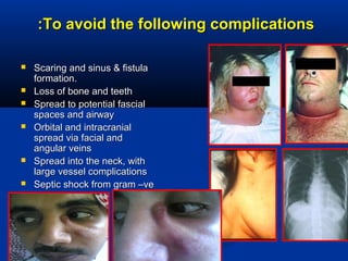 To avoid the following complicationsTo avoid the following complications::
 Scaring and sinus & fistulaScaring and sinus & fistula
formation.formation.
 Loss of bone and teethLoss of bone and teeth
 Spread to potential fascialSpread to potential fascial
spaces and airwayspaces and airway
 Orbital and intracranialOrbital and intracranial
spread via facial andspread via facial and
angular veinsangular veins
 Spread into the neck, withSpread into the neck, with
large vessel complicationslarge vessel complications
 Septic shock from gram –veSeptic shock from gram –ve
 