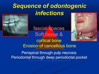 Sequence of odontogenicSequence of odontogenic
infectionsinfections
fascial spaces
Soft tissue &
cortical bone
Erosion of cancellous bone
Periapical through pulp necrosis
Periodontal through deep periodontal pocket
 