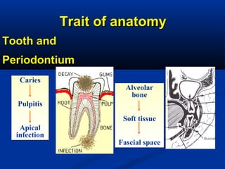 Alveolar
bone
Soft tissue
Fascial space
Alveolar
bone
Soft tissue
Fascial space
Trait of anatomyTrait of anatomy
Tooth andTooth and
PeriodontiumPeriodontium
Caries
Pulpitis
Apical
infection
Caries
Pulpitis
Apical
infection
 