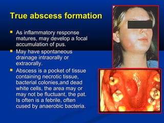 True abscess formationTrue abscess formation
 As inflammatory responseAs inflammatory response
matures, may develop a focalmatures, may develop a focal
accumulation of pus.accumulation of pus.
 May have spontaneousMay have spontaneous
drainage intraorally ordrainage intraorally or
extraorally.extraorally.
 Abscess is a pocket of tissueAbscess is a pocket of tissue
containing necrotic tissue,containing necrotic tissue,
bacterial colonies,and deadbacterial colonies,and dead
white cells, the area may orwhite cells, the area may or
may not be fluctuant, the pat.may not be fluctuant, the pat.
Is often is a febrile, oftenIs often is a febrile, often
cused by anaerobic bacteria.cused by anaerobic bacteria.
 