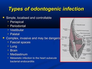 Types of odontogenic infectionTypes of odontogenic infection
 Simple, localised and controllableSimple, localised and controllable
 PeriapicalPeriapical
 PeriodontalPeriodontal
 VestibularVestibular
 PalatalPalatal
 Complex, invasive and may be dangerousComplex, invasive and may be dangerous
 Fascial spacesFascial spaces
 LungLung
 BrainBrain
 MediastinumMediastinum
 Metastatic infection to the heart subacuteMetastatic infection to the heart subacute
bacterial endocarditisbacterial endocarditis
 