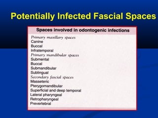 Potentially Infected Fascial Spaces
 