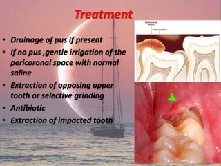 Treatment
• Drainage of pus if present
• If no pus ,gentle irrigation of the
pericoronal space with normal
saline
• Extraction of opposing upper
tooth or selective grinding
• Antibiotic
• Extraction of impacted tooth
 