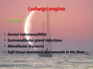 Ludwigs angina
• Causes
• Dental infections(90%)
• Sunmandibular gland infections
• Mandibular fractures
• Soft tissue laceratios and wounds in the floor
 