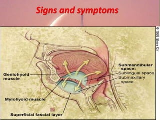 Signs and symptoms
 