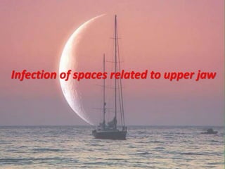 Infection of spaces related to upper jaw
 