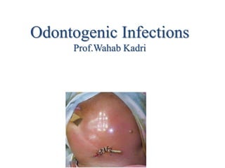 Odontogenic Infections
Prof.Wahab Kadri
 